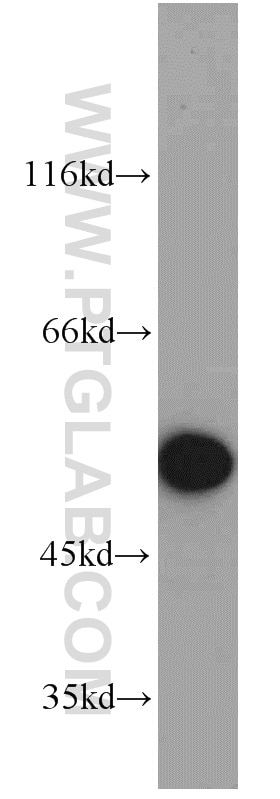 Western Blot (WB) analysis of HepG2 cells using ALDH1B1 Polyclonal antibody (22220-1-AP)