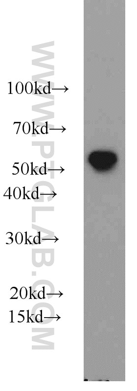 Western Blot (WB) analysis of mouse testis tissue using ALDH1B1 Polyclonal antibody (22220-1-AP)
