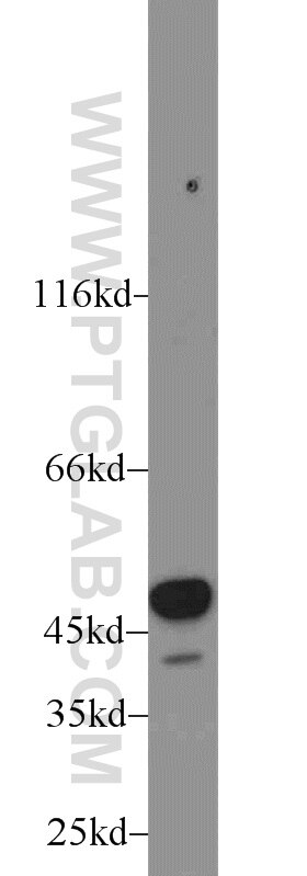 Western Blot (WB) analysis of rat brain tissue using ALDH1B1 Polyclonal antibody (22220-1-AP)