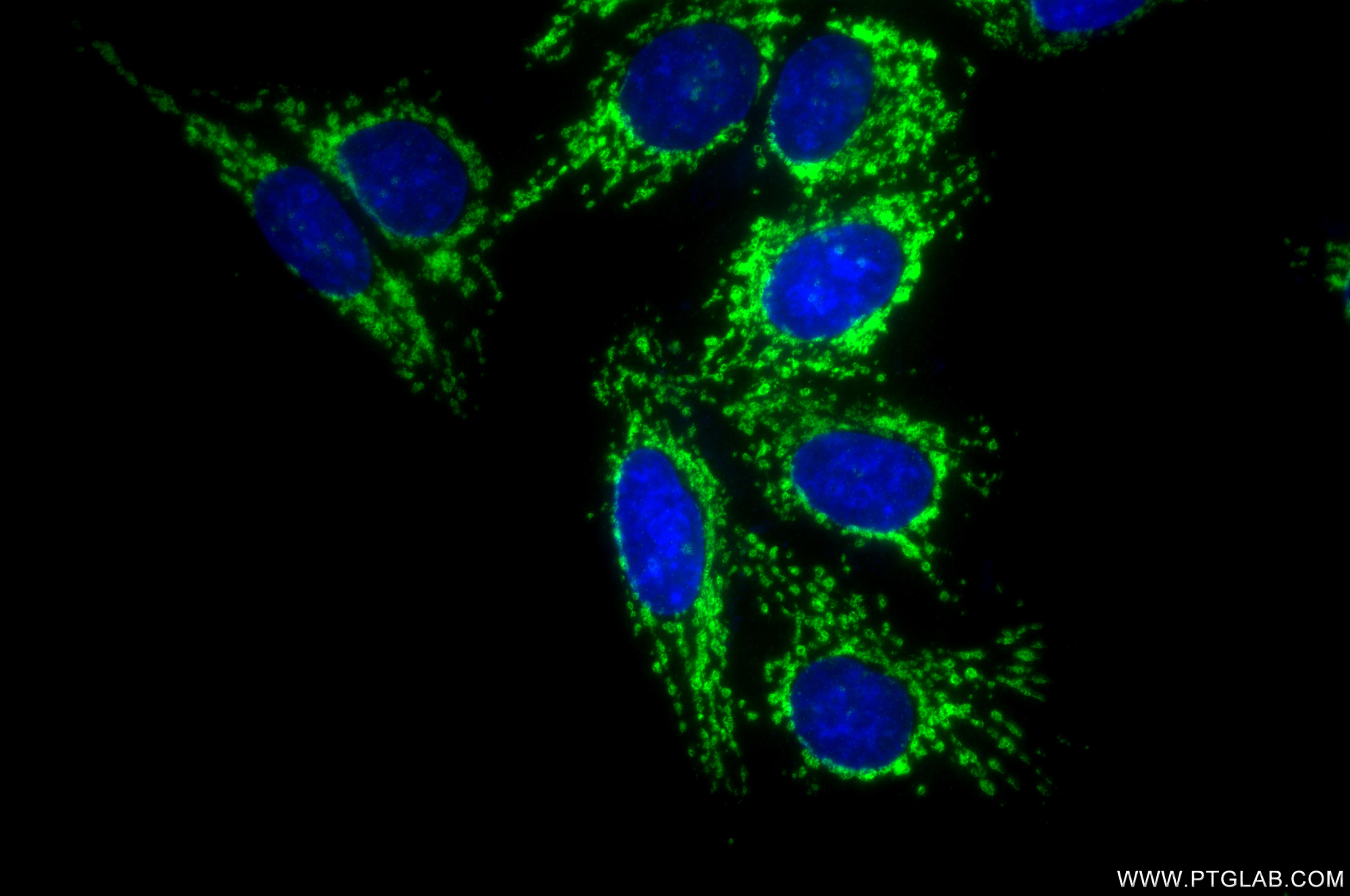 Immunofluorescence (IF) / fluorescent staining of HepG2 cells using ALDH1B1 Recombinant monoclonal antibody (85426-2-RR)