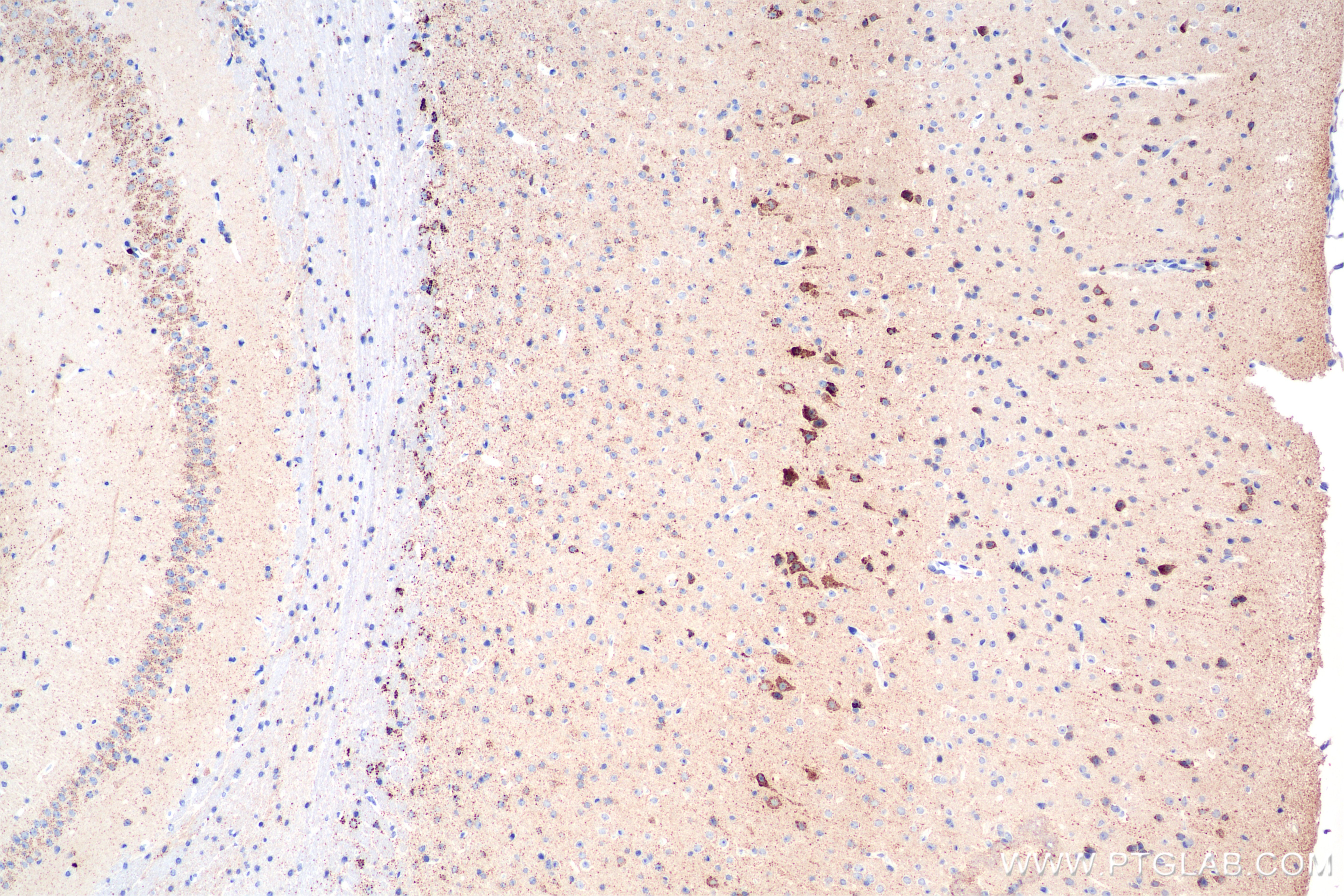 Immunohistochemistry (IHC) staining of mouse brain tissue using ALDH1B1 Recombinant monoclonal antibody (85426-2-RR)
