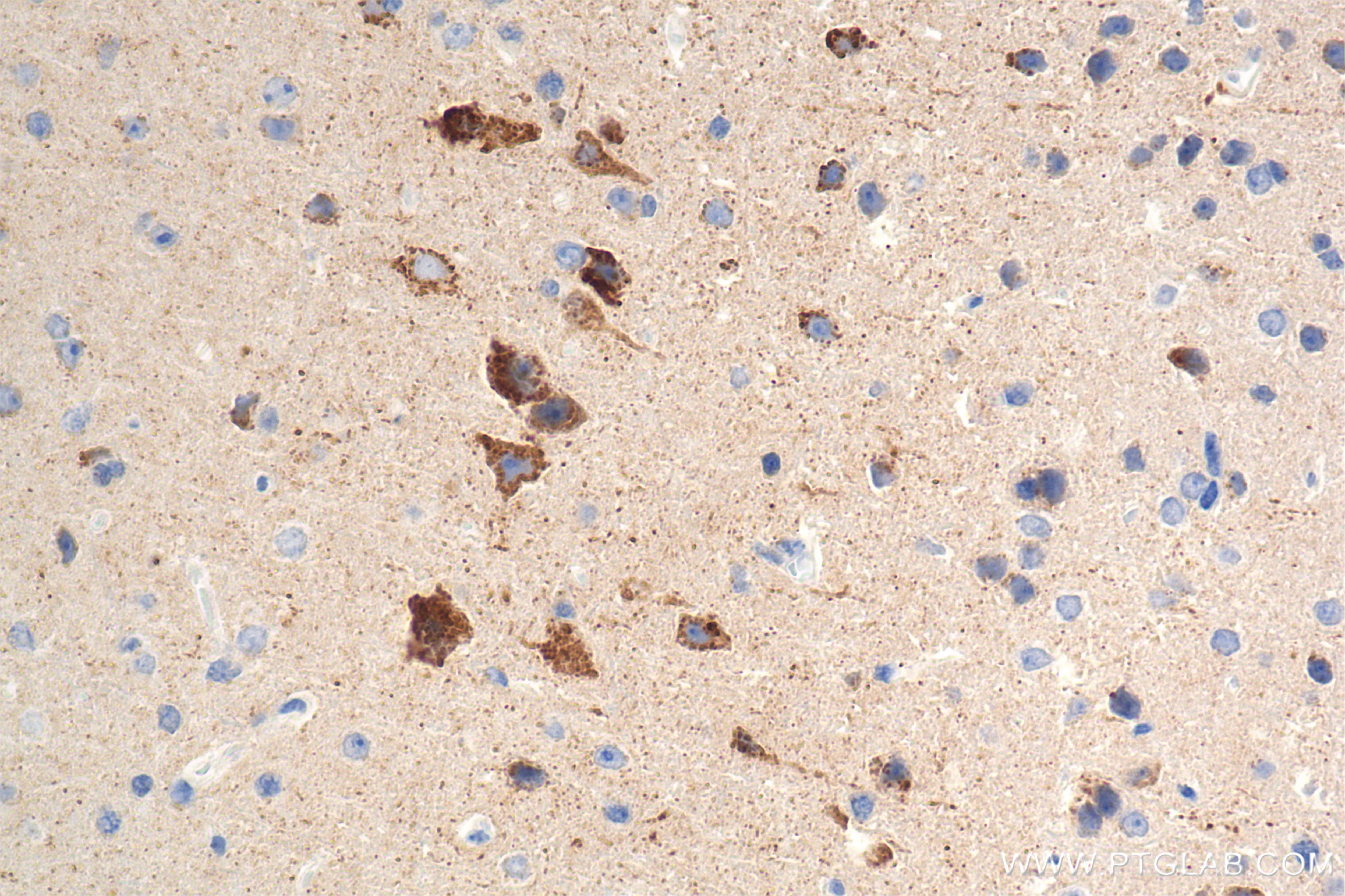 Immunohistochemistry (IHC) staining of mouse brain tissue using ALDH1B1 Recombinant monoclonal antibody (85426-2-RR)