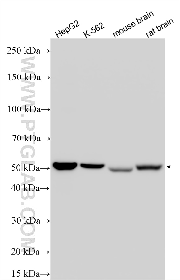 Western Blot (WB) analysis of various lysates using ALDH1B1 Recombinant monoclonal antibody (85426-2-RR)
