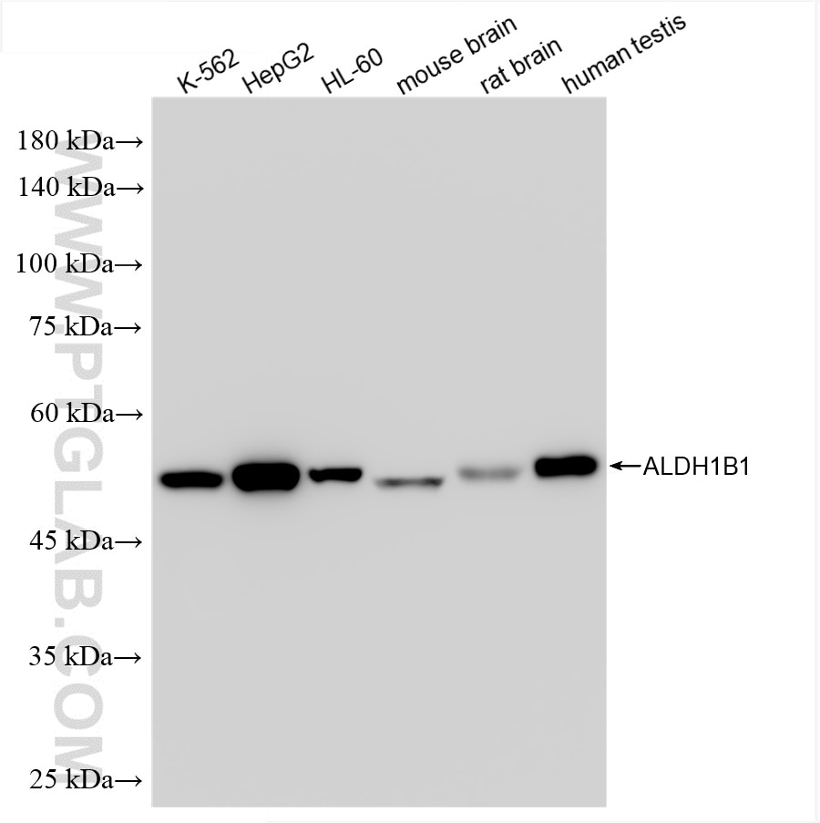 Western Blot (WB) analysis of various lysates using ALDH1B1 Recombinant antibody (85426-4-RR)