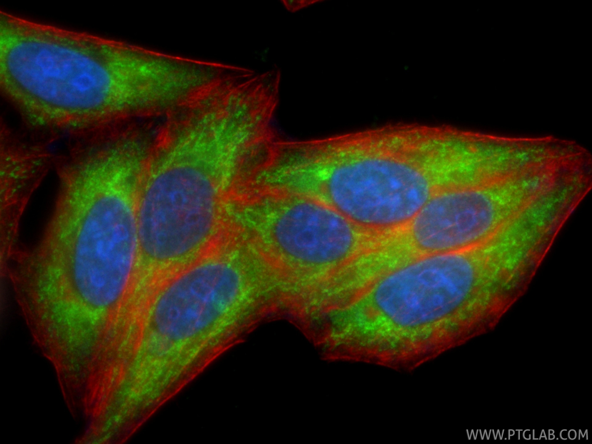 IF Staining of HepG2 using CL488-85426-2 Immunofluorescence (IF) / fluorescent staining of HepG2 cells using CoraLite® Plus 488-conjugated ALDH1B1 Recombinant (CL488-85426-2)