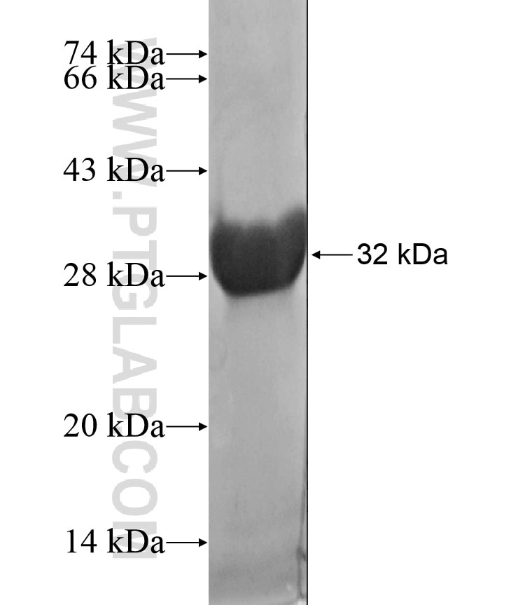 ALDH1B1 fusion protein Ag17557 SDS-PAGE