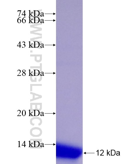 ALDH1B1 fusion protein Ag17614 SDS-PAGE
