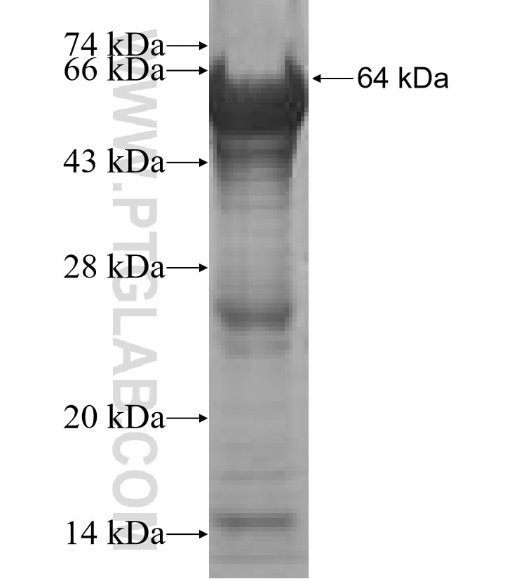 ALDH1B1 fusion protein Ag7144 SDS-PAGE