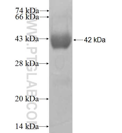 ALDH1B1 fusion protein Ag7228 SDS-PAGE