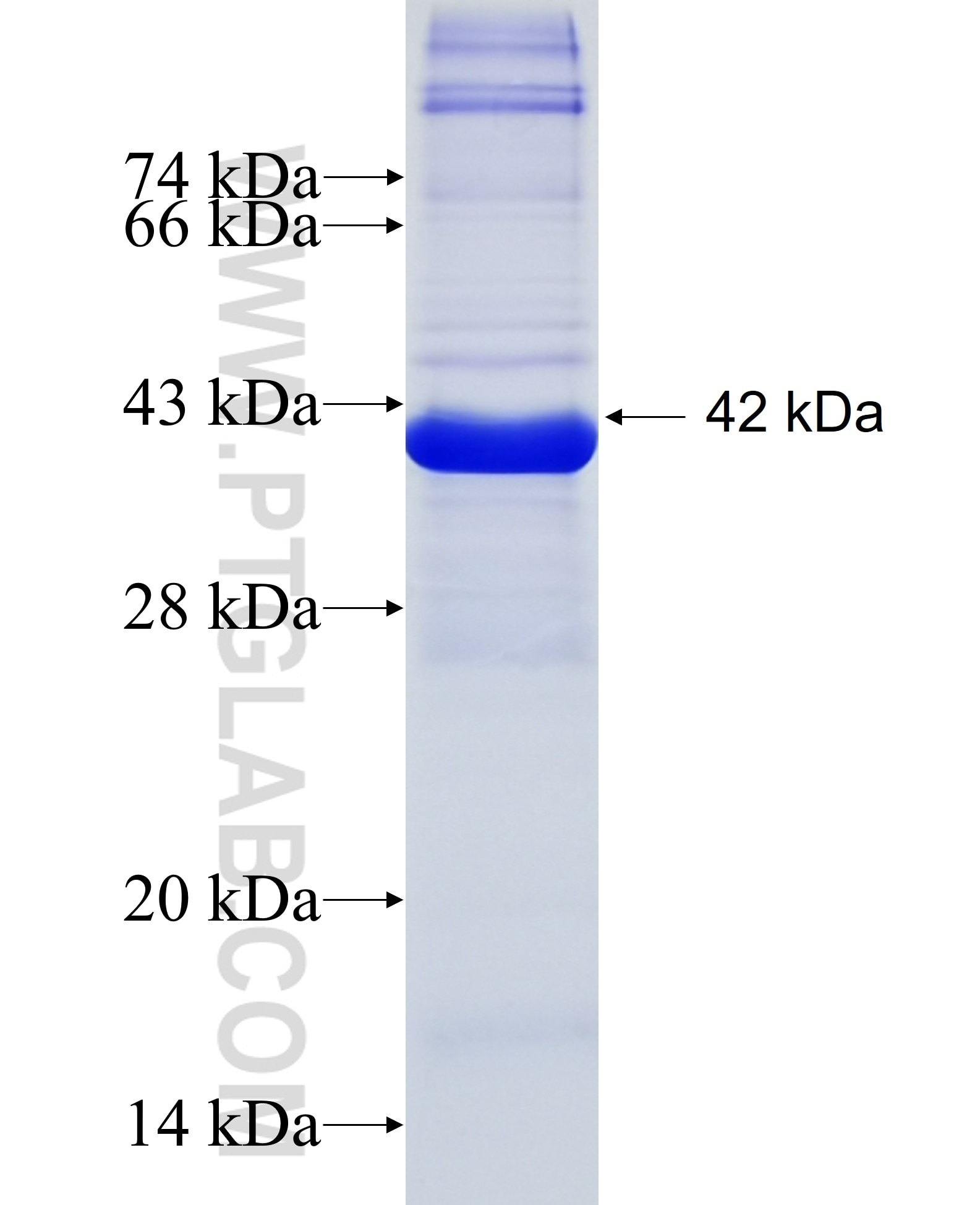 ALDH1B1 fusion protein Ag7228 SDS-PAGE