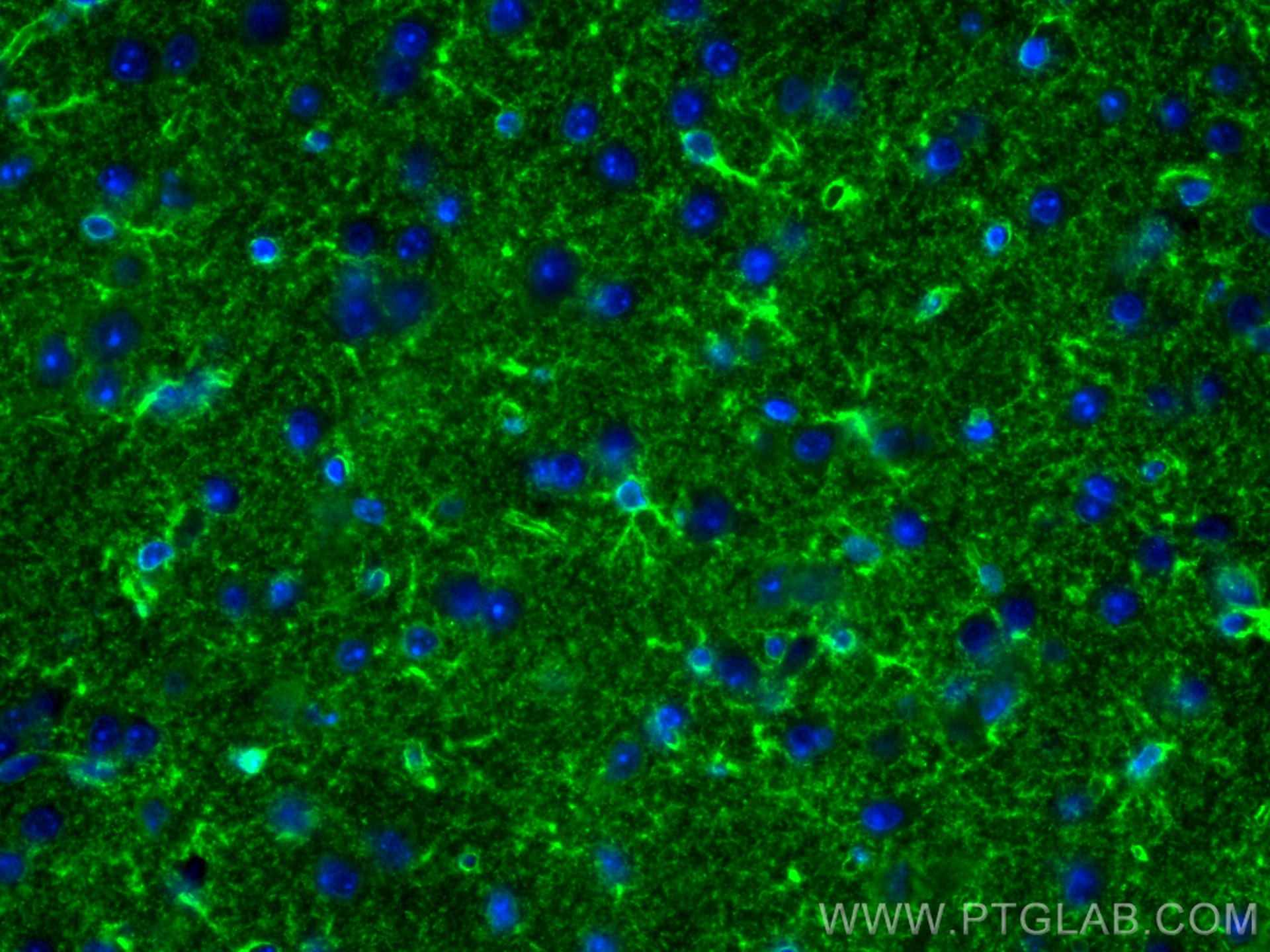 Immunofluorescence (IF) / fluorescent staining of mouse brain tissue using ALDH1L1 Polyclonal antibody (17390-1-AP)