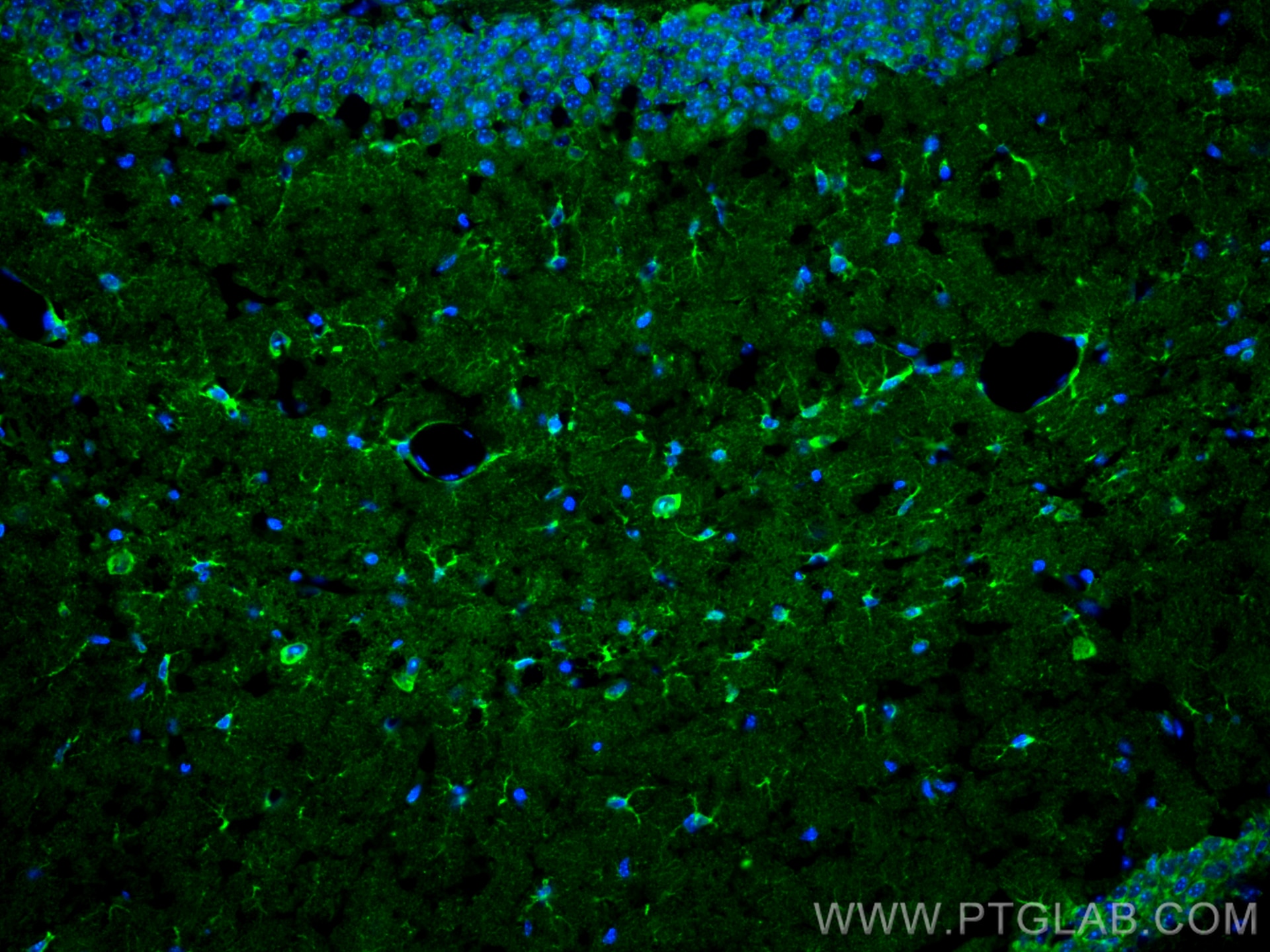 Immunofluorescence (IF) / fluorescent staining of mouse brain tissue using ALDH1L1 Polyclonal antibody (17390-1-AP)