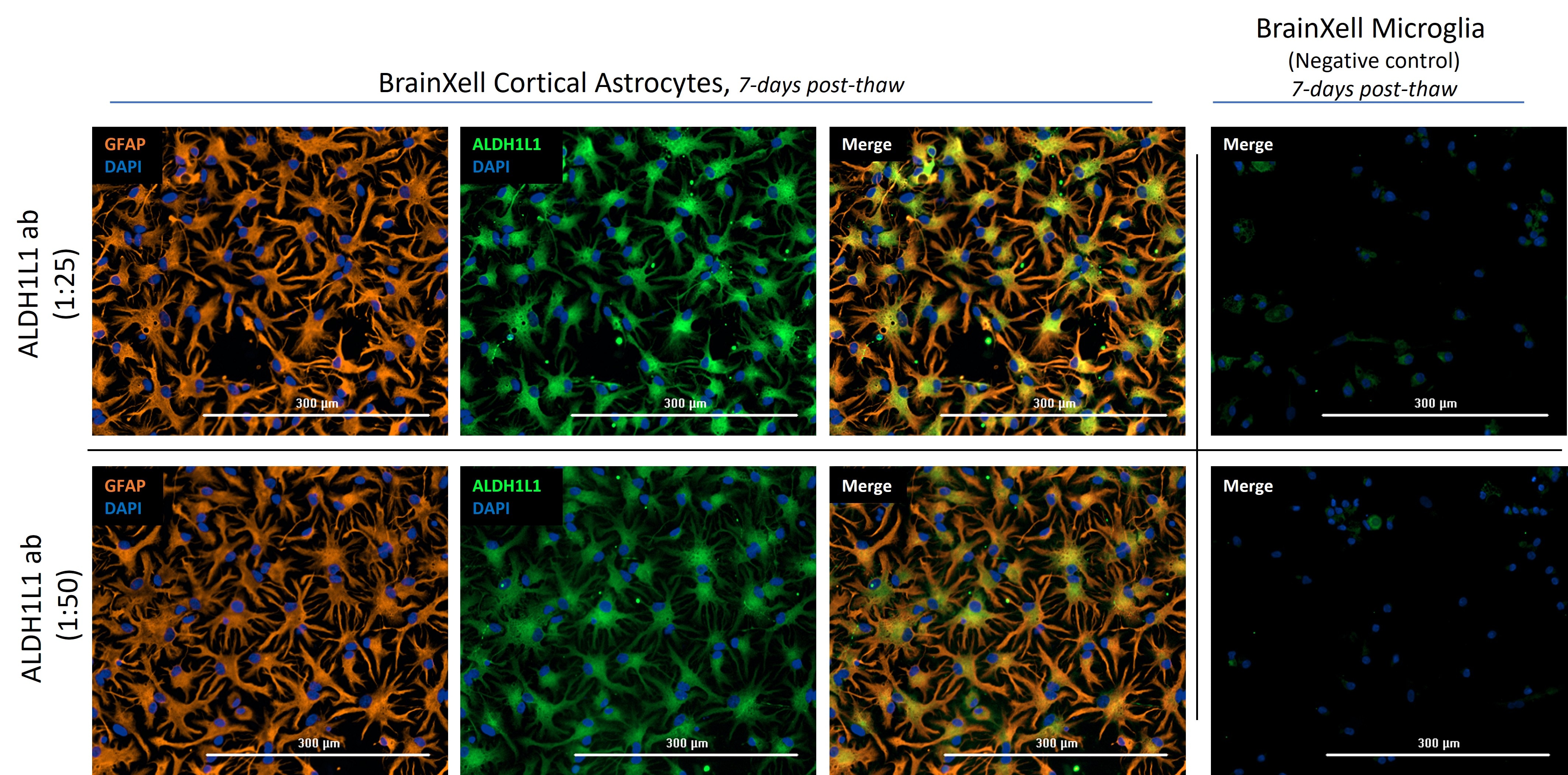 Immunofluorescence (IF) / fluorescent staining of hiPSC-derived cortical astrocytes (7 DIV) using ALDH1L1 Polyclonal antibody (17390-1-AP)