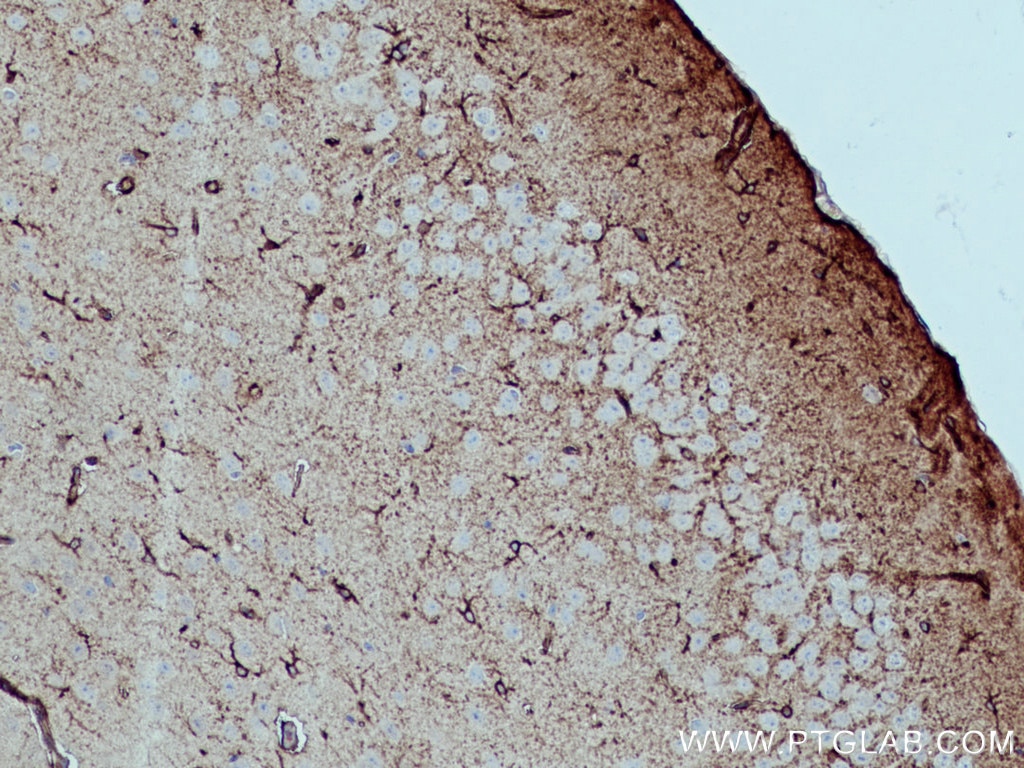 Immunohistochemistry (IHC) staining of mouse brain tissue using ALDH1L1 Polyclonal antibody (17390-1-AP)