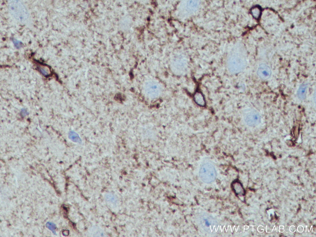 Immunohistochemistry (IHC) staining of mouse brain tissue using ALDH1L1 Polyclonal antibody (17390-1-AP)