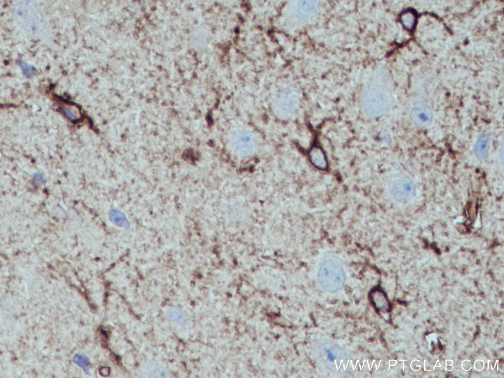 IHC staining of mouse brain using 17390-1-AP