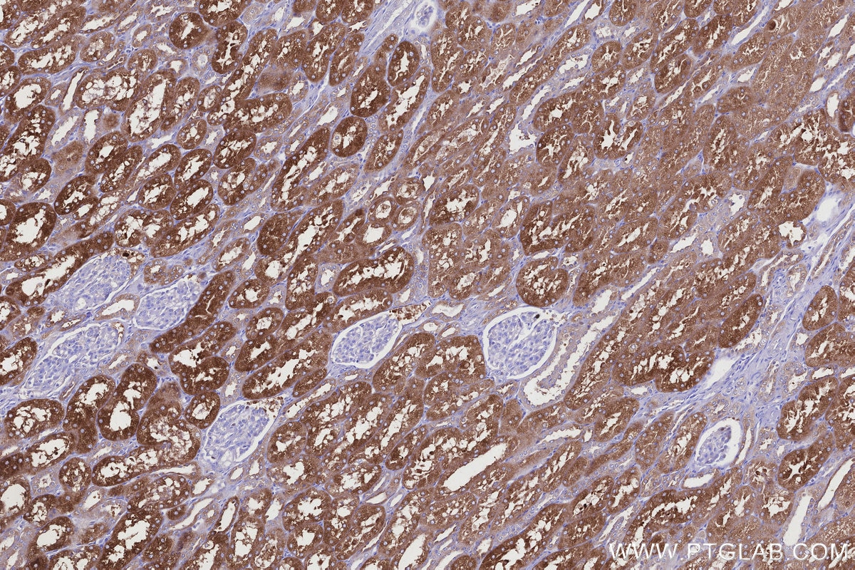 Immunohistochemistry (IHC) staining of human kidney tissue using ALDH1L1 Polyclonal antibody (17390-1-AP)
