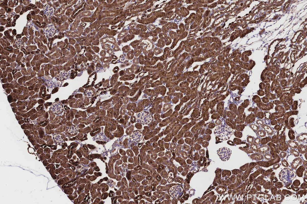 Immunohistochemistry (IHC) staining of mouse kidney tissue using ALDH1L1 Polyclonal antibody (17390-1-AP)