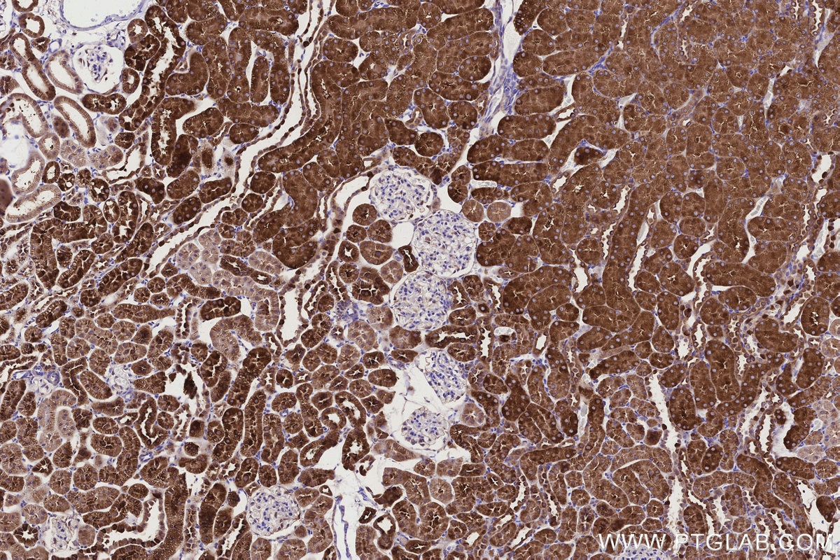 Immunohistochemistry (IHC) staining of rat kidney tissue using ALDH1L1 Polyclonal antibody (17390-1-AP)