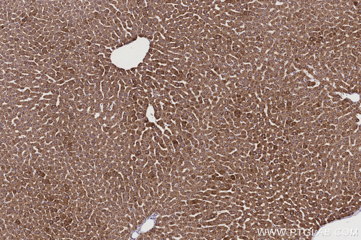 Immunohistochemistry (IHC) staining of rat liver tissue using ALDH1L1 Polyclonal antibody (17390-1-AP)