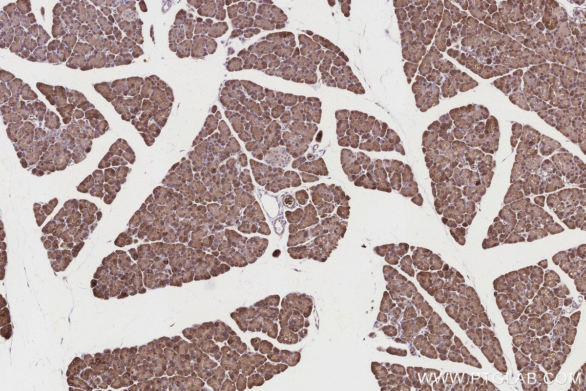 Immunohistochemistry (IHC) staining of rat pancreas tissue using ALDH1L1 Polyclonal antibody (17390-1-AP)