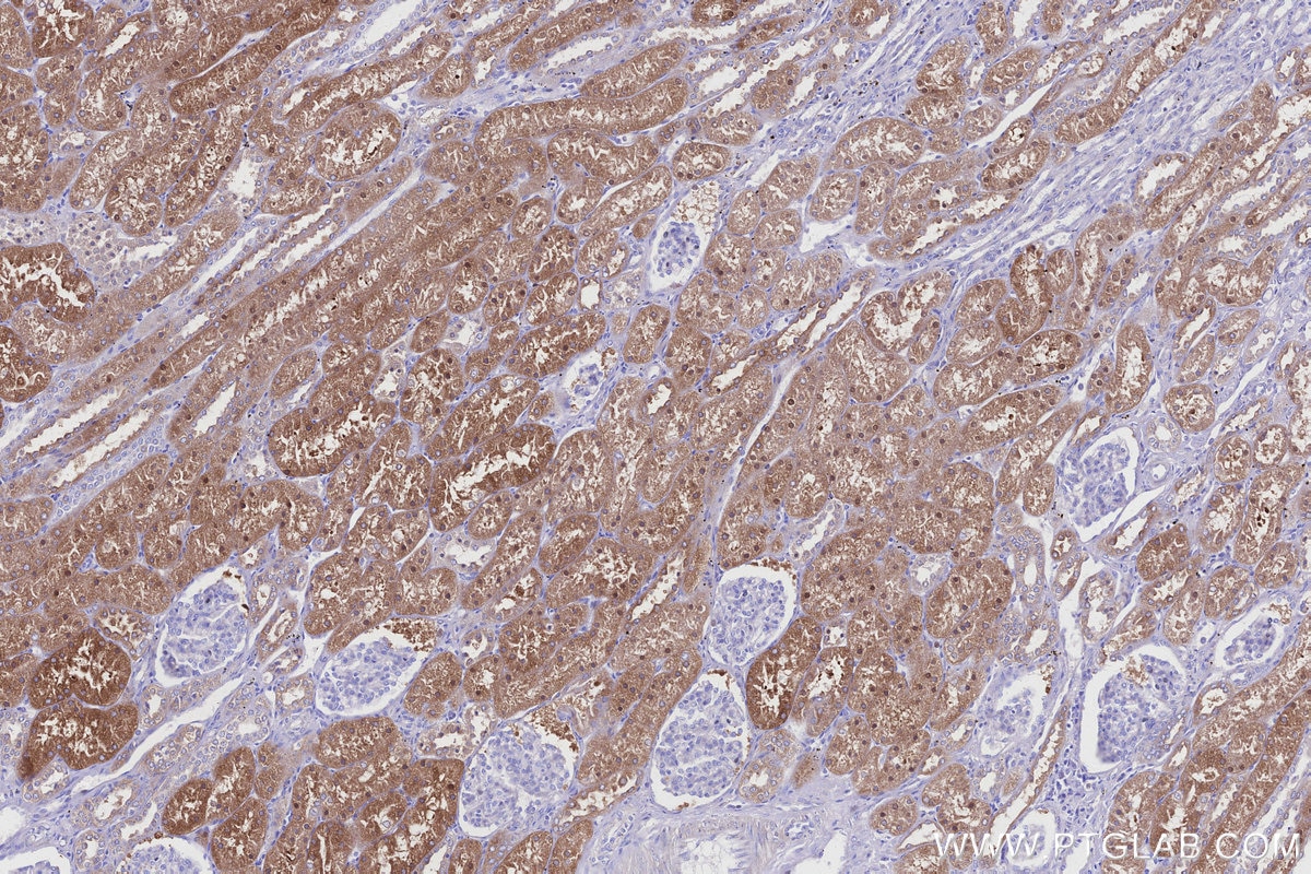Immunohistochemistry (IHC) staining of human kidney tissue using ALDH1L1 Polyclonal antibody (17390-1-AP)
