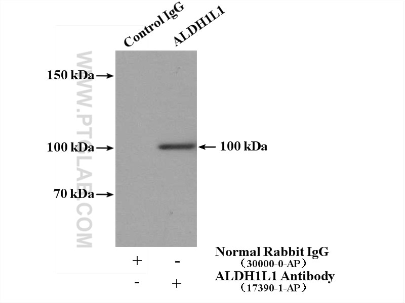 Immunoprecipitation (IP) experiment of mouse liver tissue using ALDH1L1 Polyclonal antibody (17390-1-AP)