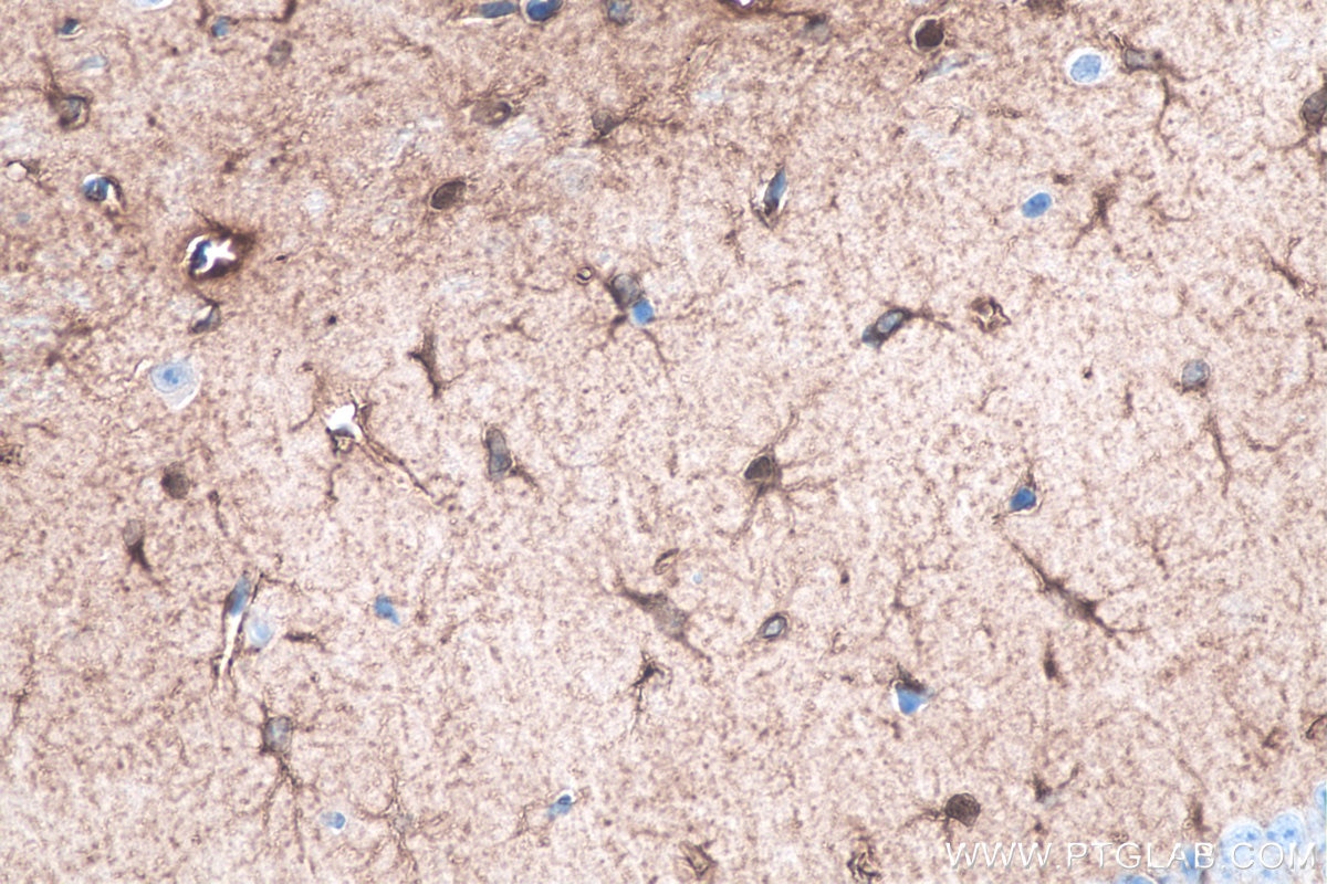 Immunohistochemistry (IHC) staining of mouse brain tissue using ALDH1L1 Monoclonal antibody (68018-1-Ig)