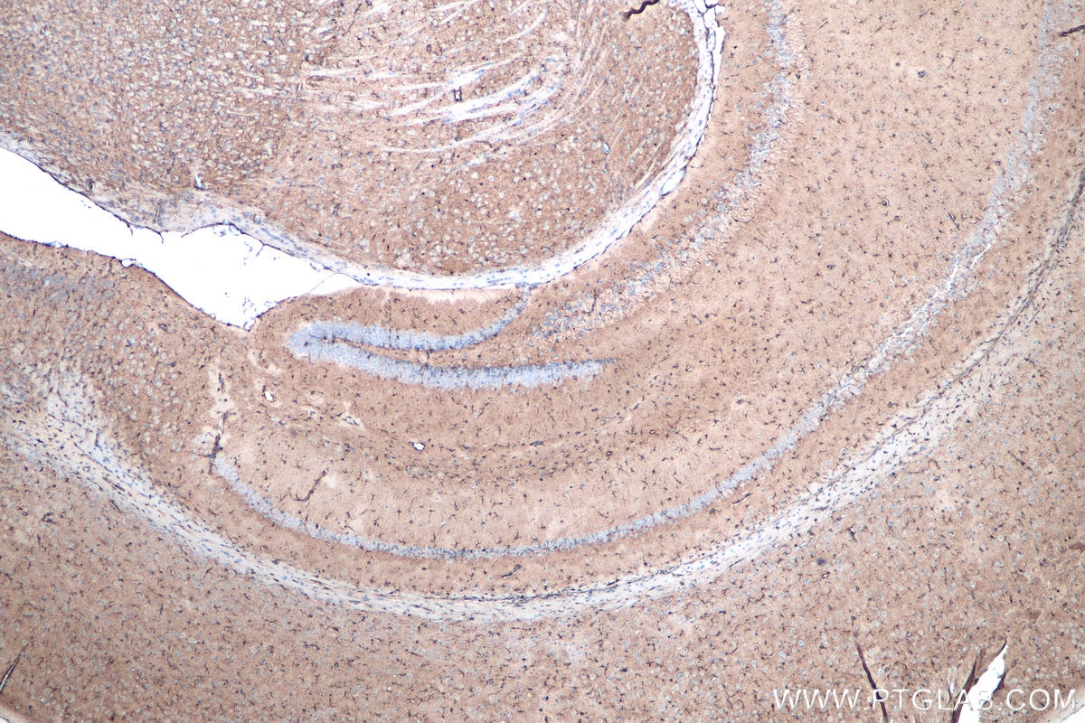 Immunohistochemistry (IHC) staining of mouse brain tissue using ALDH1L1 Monoclonal antibody (68018-1-Ig)