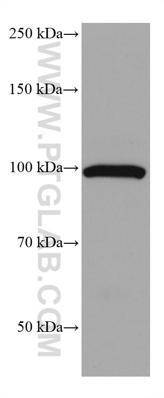 Western Blot (WB) analysis of human colostrum using ALDH1L1 Monoclonal antibody (68018-1-Ig)