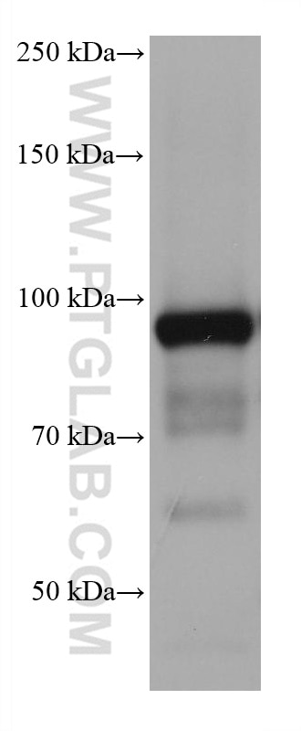 Western Blot (WB) analysis of pig liver tissue using ALDH1L1 Monoclonal antibody (68018-1-Ig)