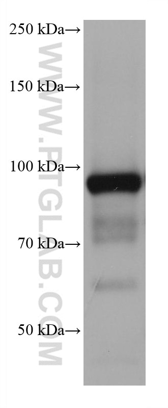 WB analysis of pig liver using 68018-1-Ig