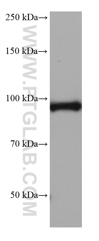 Western Blot (WB) analysis of rat liver tissue using ALDH1L1 Monoclonal antibody (68018-1-Ig)