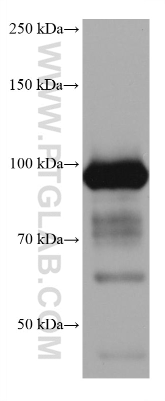 Western Blot (WB) analysis of mouse liver tissue using ALDH1L1 Monoclonal antibody (68018-1-Ig)