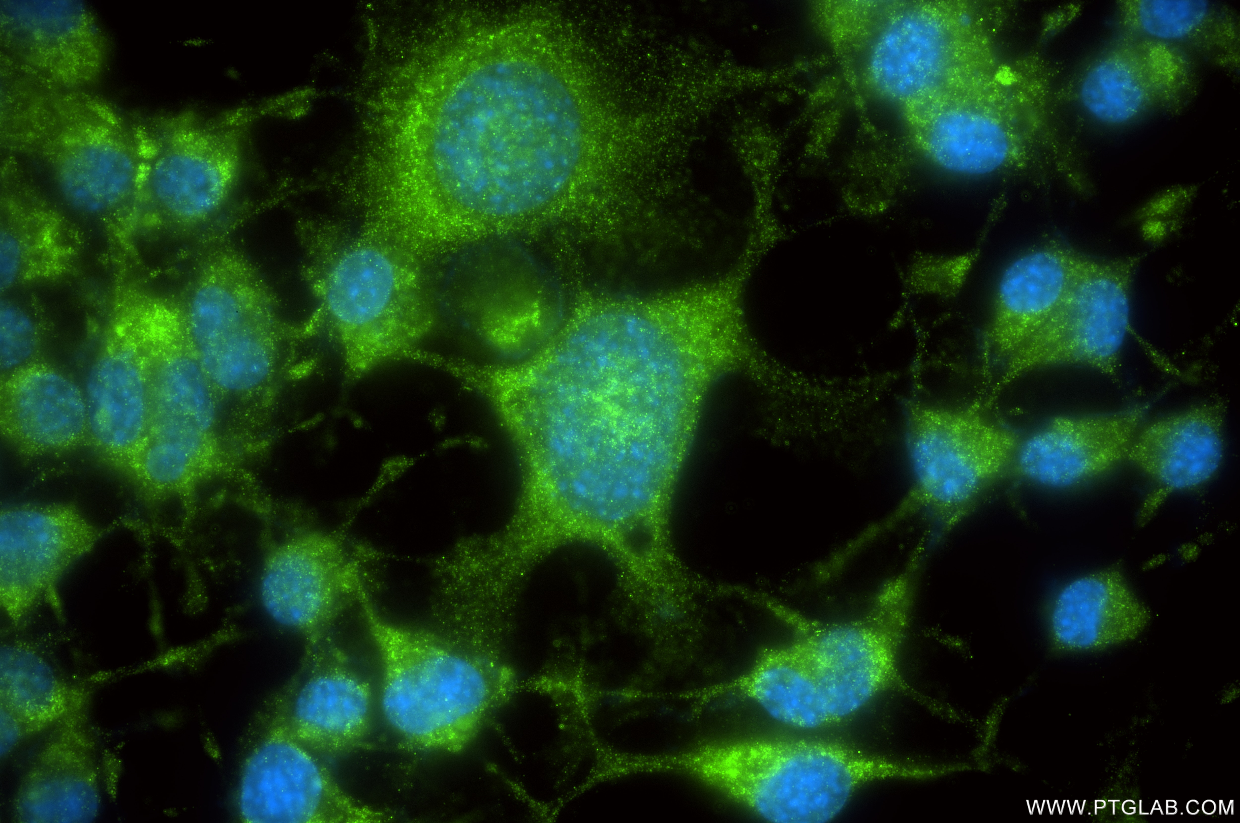 Immunofluorescence (IF) / fluorescent staining of Neuro-2a cells using ALDH1L1 Recombinant antibody (85980-2-RR)