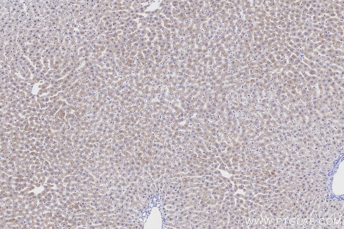 Immunohistochemistry (IHC) staining of rat liver tissue using ALDH1L1 Recombinant monoclonal antibody (85980-2-RR)