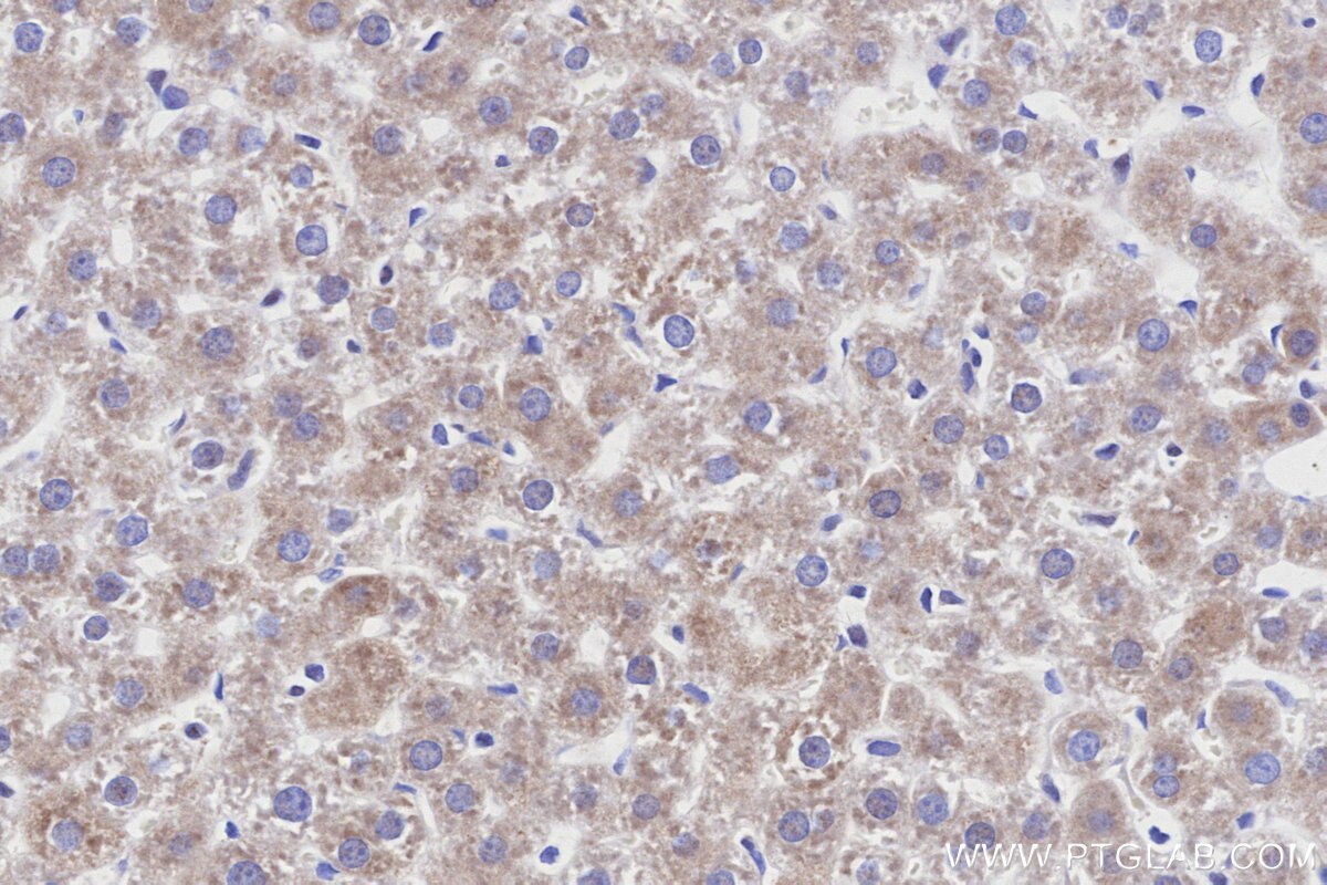 Immunohistochemistry (IHC) staining of rat liver tissue using ALDH1L1 Recombinant monoclonal antibody (85980-2-RR)