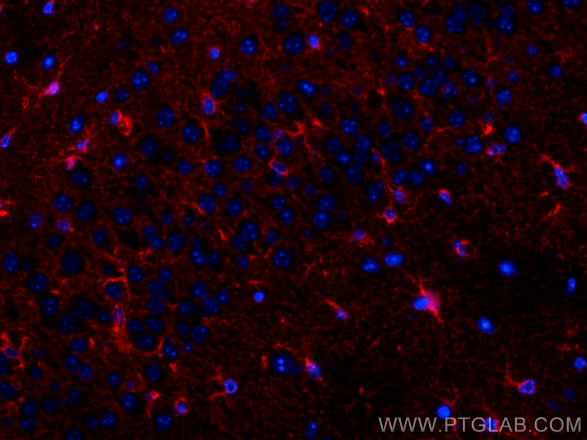 Immunofluorescence (IF) / fluorescent staining of mouse brain tissue using CoraLite®594-conjugated ALDH1L1 Monoclonal antibod (CL594-68018)