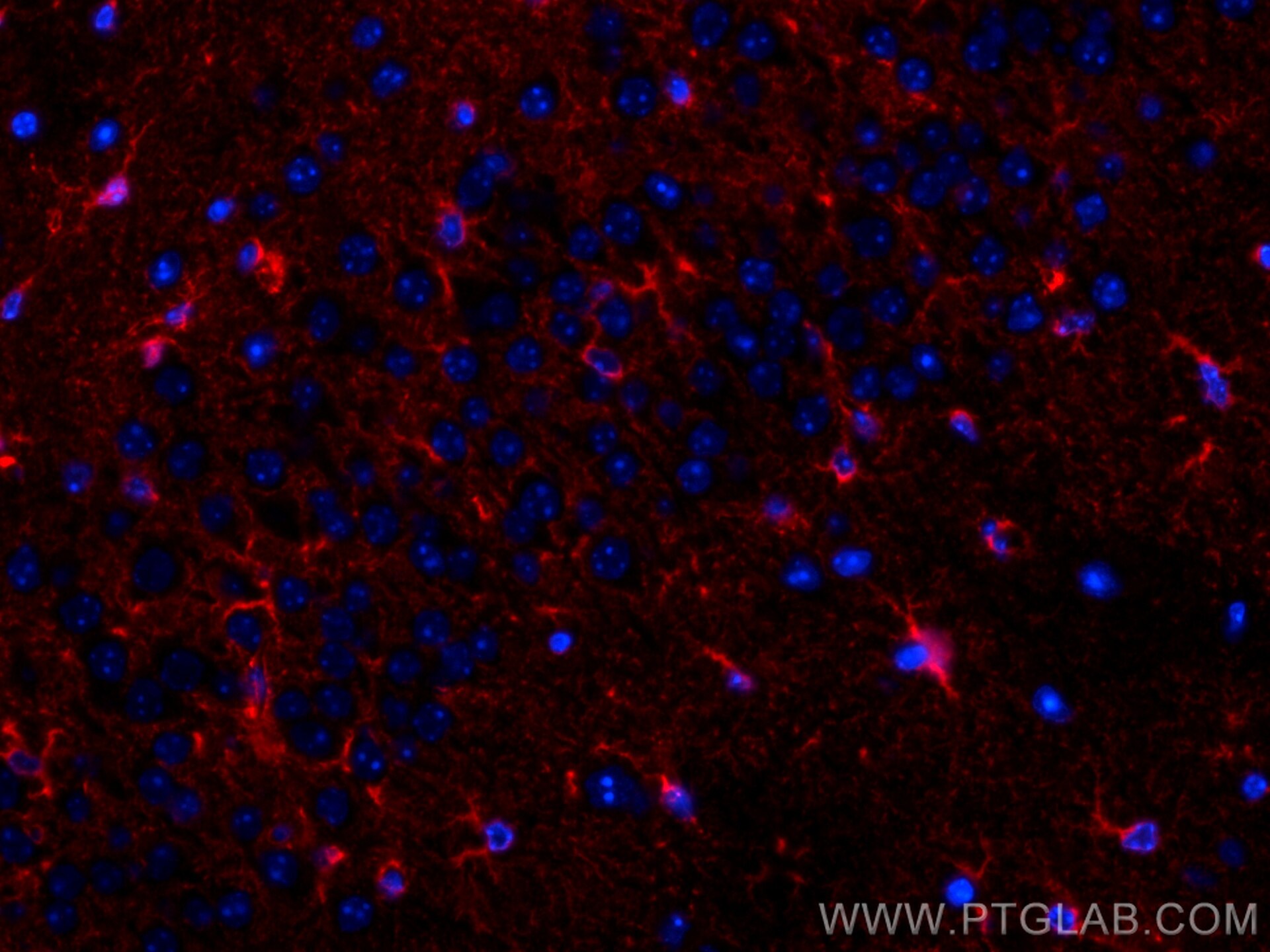 Immunofluorescence (IF) / fluorescent staining of mouse brain tissue using CoraLite®594-conjugated ALDH1L1 Monoclonal antibod (CL594-68018)