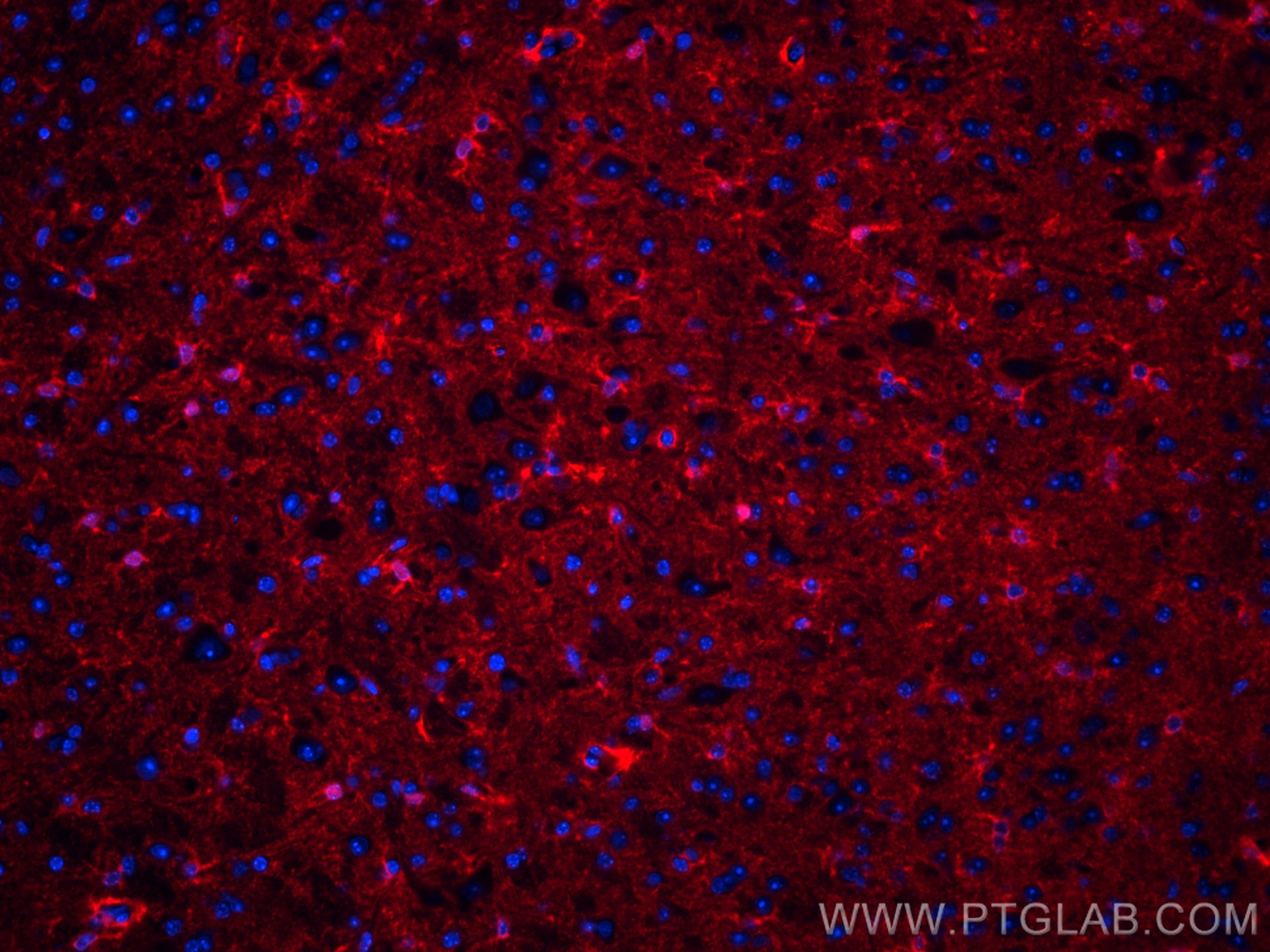 Immunofluorescence (IF) / fluorescent staining of mouse brain tissue using CoraLite®594-conjugated ALDH1L1 Monoclonal antibod (CL594-68018)