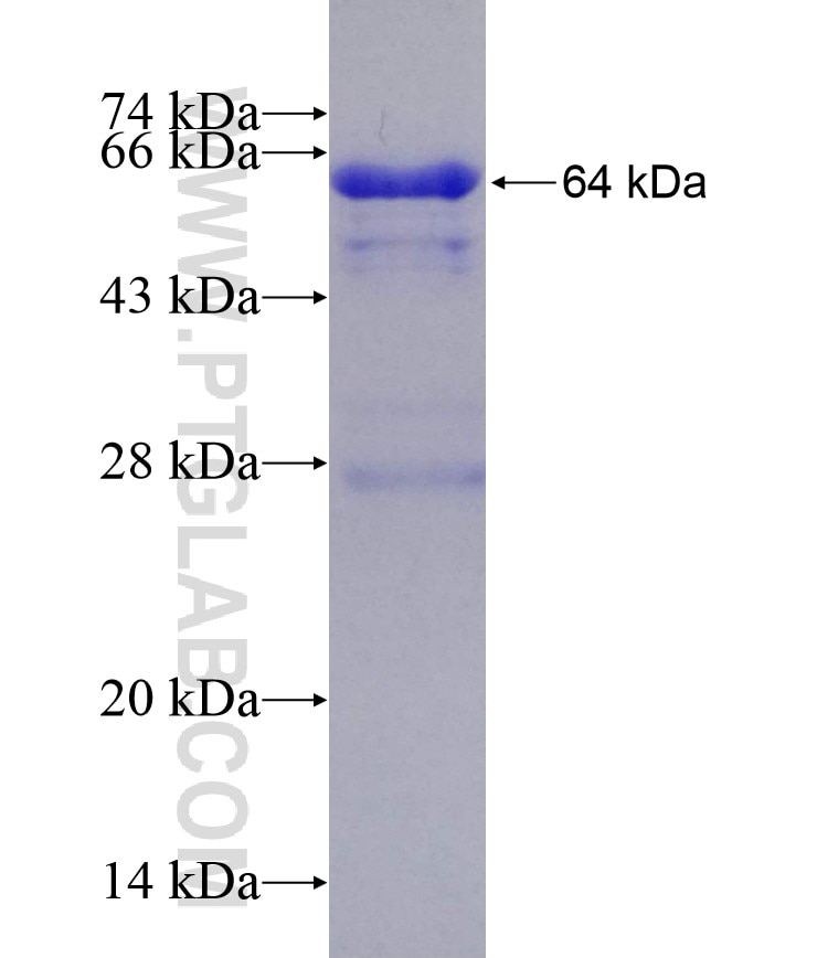 ALDH1L1 fusion protein Ag11285 SDS-PAGE