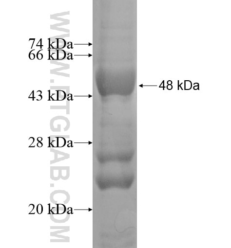 ALDH1L1 fusion protein Ag13190 SDS-PAGE