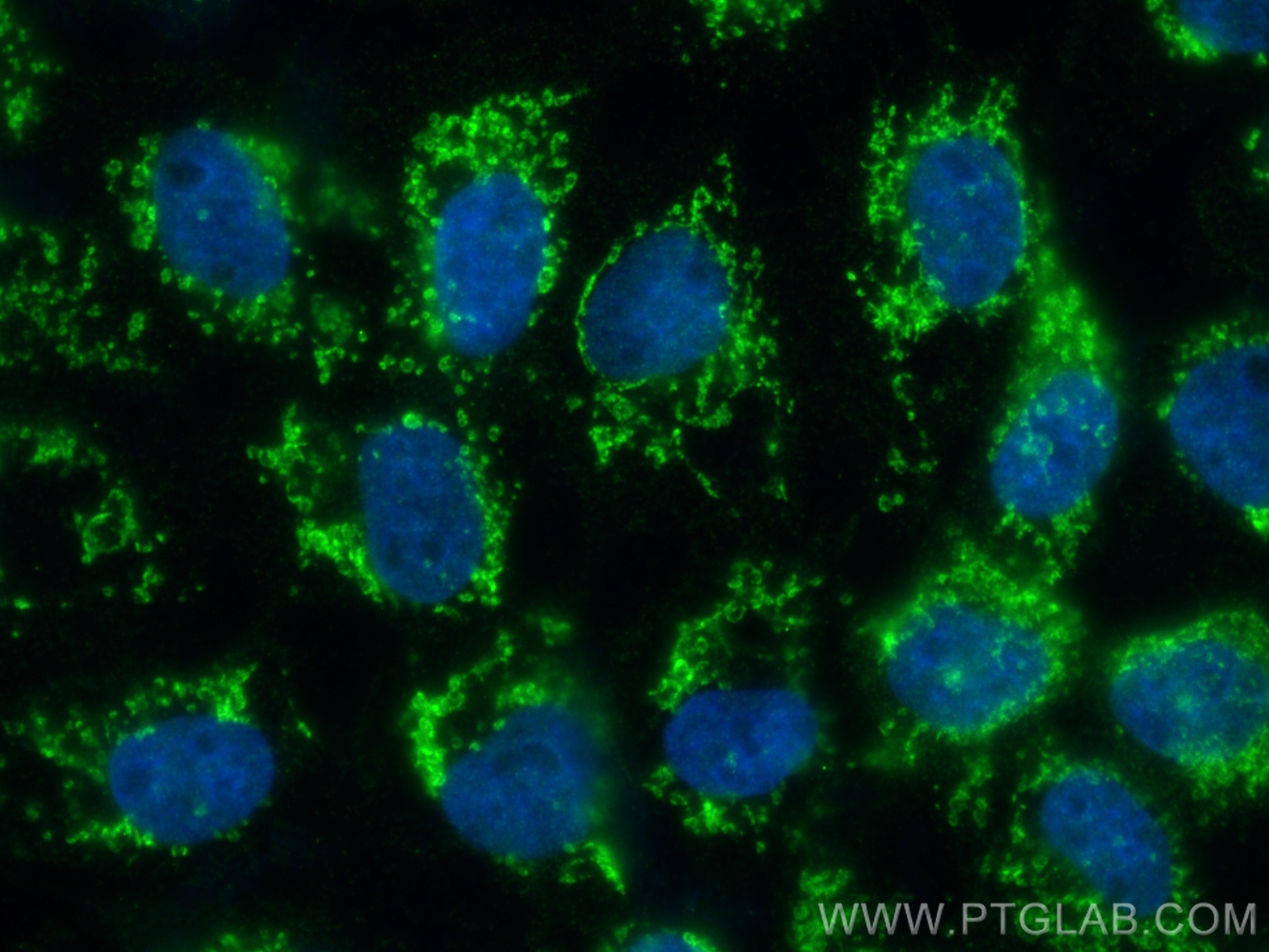 Immunofluorescence (IF) / fluorescent staining of A431 cells using ALDH1L2 Polyclonal antibody (21391-1-AP)