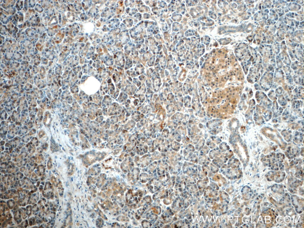 Immunohistochemistry (IHC) staining of human pancreas tissue using ALDH1L2 Polyclonal antibody (21391-1-AP)