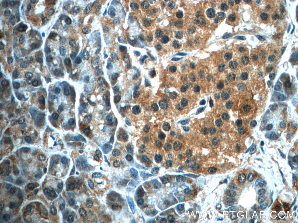 Immunohistochemistry (IHC) staining of human pancreas tissue using ALDH1L2 Polyclonal antibody (21391-1-AP)