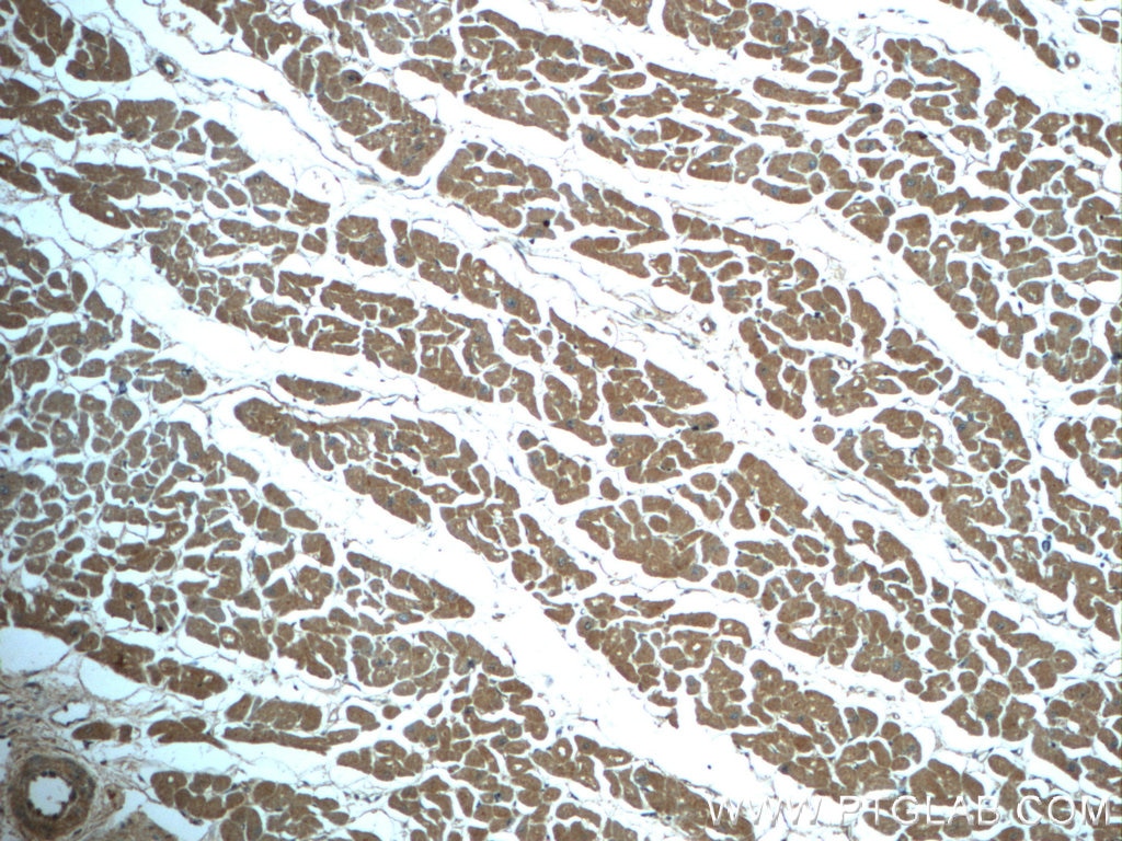 Immunohistochemistry (IHC) staining of human heart tissue using ALDH1L2 Polyclonal antibody (21391-1-AP)