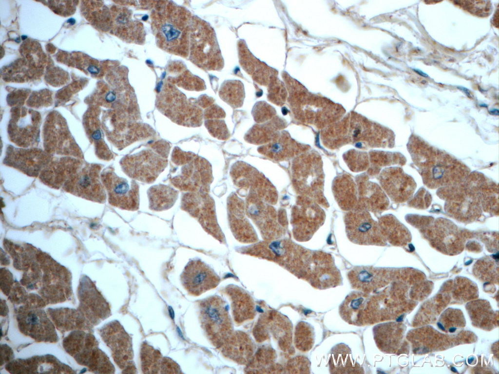 Immunohistochemistry (IHC) staining of human heart tissue using ALDH1L2 Polyclonal antibody (21391-1-AP)