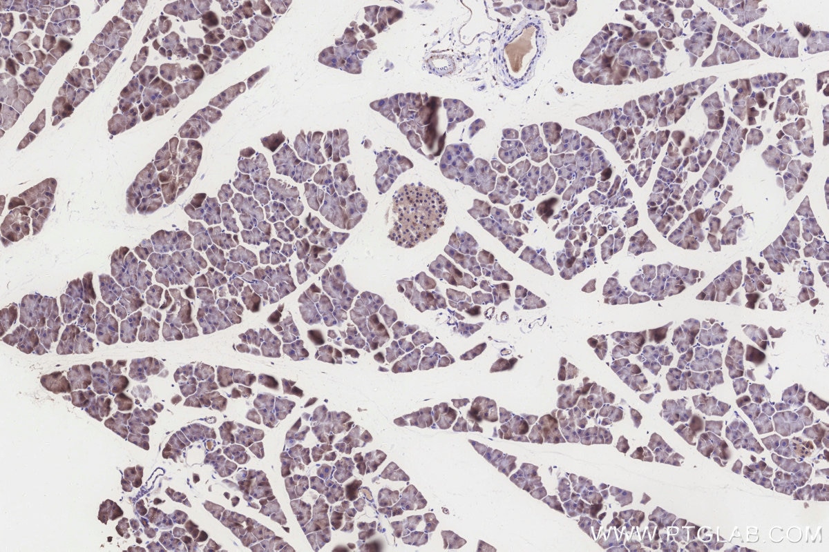 Immunohistochemistry (IHC) staining of mouse pancreas tissue using ALDH1L2 Polyclonal antibody (21391-1-AP)