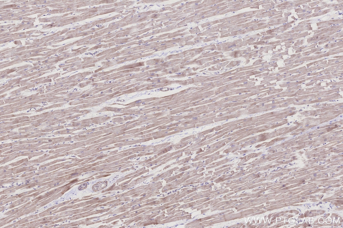 Immunohistochemistry (IHC) staining of human heart tissue using ALDH1L2 Polyclonal antibody (21391-1-AP)