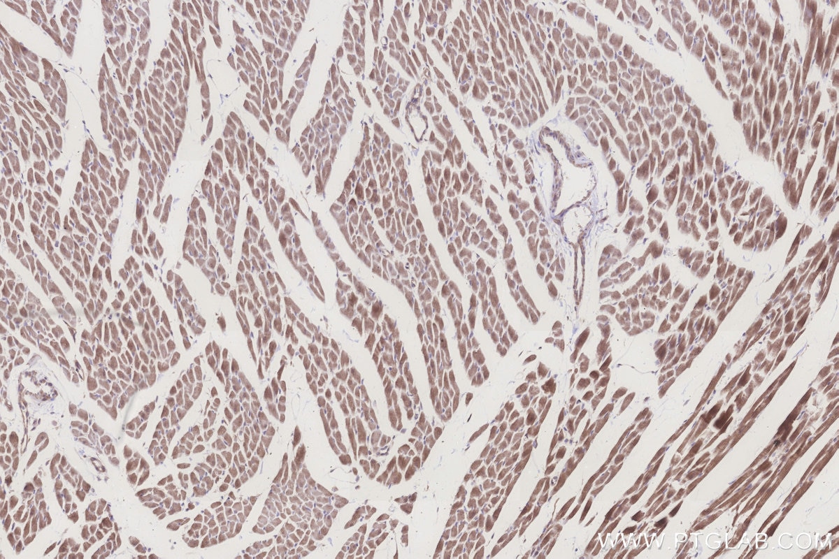 Immunohistochemistry (IHC) staining of rat heart tissue using ALDH1L2 Polyclonal antibody (21391-1-AP)